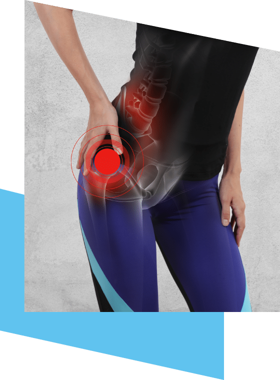 physiotherapy for hip pain Parramatta